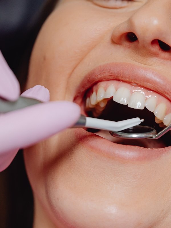 clinique dentaire waterloo - parodontologie implantologie et chirurgie dentaire à waterloo