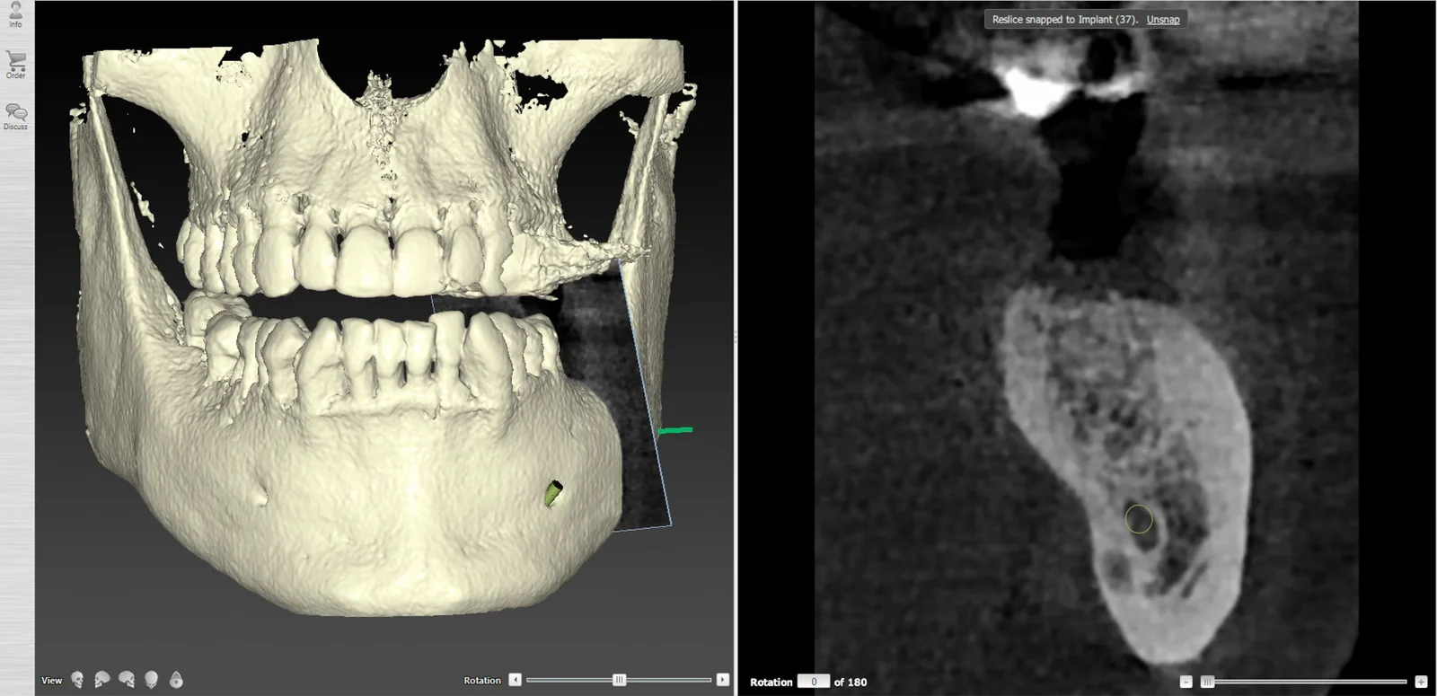 clinique dentaire waterloo - parodontologie implantologie et chirurgie dentaire à waterloo