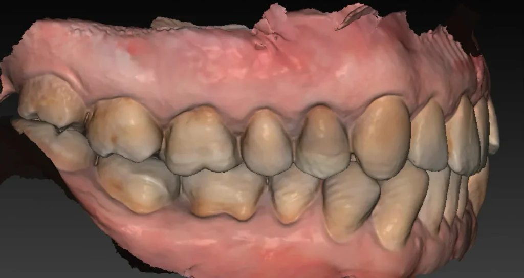 clinique dentaire waterloo - parodontologie implantologie et chirurgie dentaire à waterloo