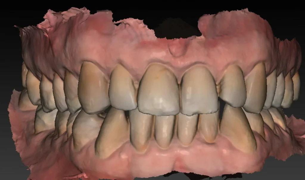 clinique dentaire waterloo - parodontologie implantologie et chirurgie dentaire à waterloo