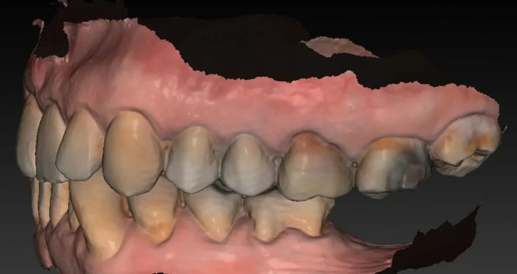 clinique dentaire waterloo - parodontologie implantologie et chirurgie dentaire à waterloo