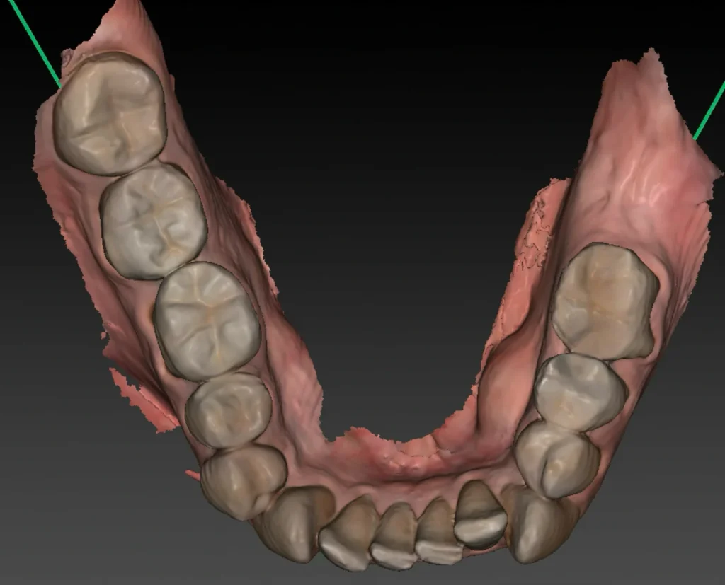 clinique dentaire waterloo - parodontologie implantologie et chirurgie dentaire à waterloo