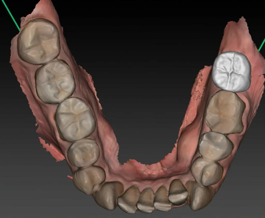 clinique dentaire waterloo - parodontologie implantologie et chirurgie dentaire à waterloo