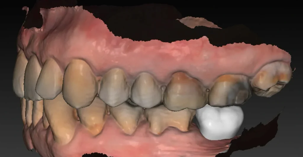 clinique dentaire waterloo - parodontologie implantologie et chirurgie dentaire à waterloo