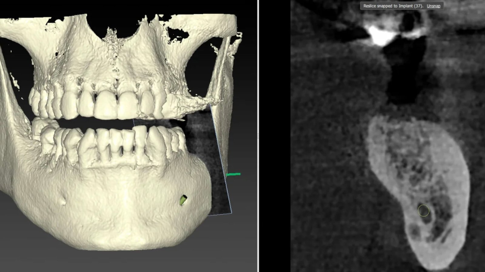 clinique dentaire waterloo - parodontologie implantologie et chirurgie dentaire à waterloo