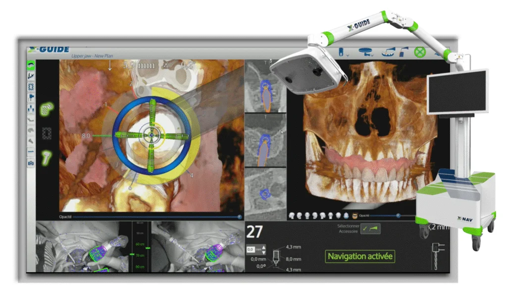 clinique dentaire waterloo - parodontologie implantologie et chirurgie dentaire à waterloo