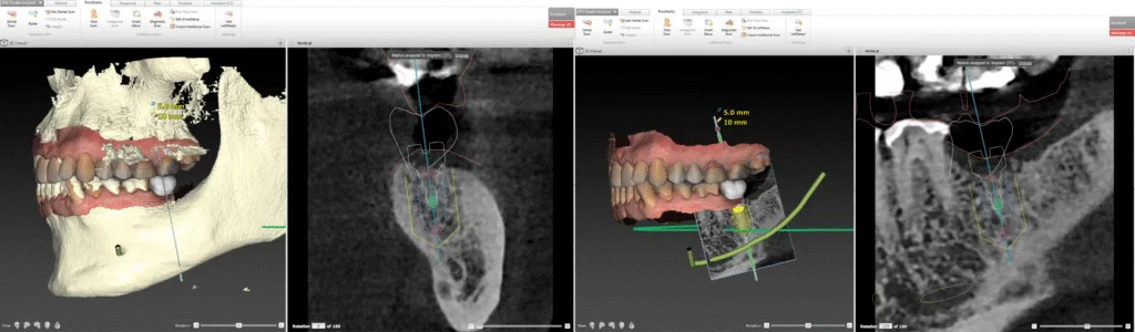 clinique dentaire waterloo - parodontologie implantologie et chirurgie dentaire à waterloo