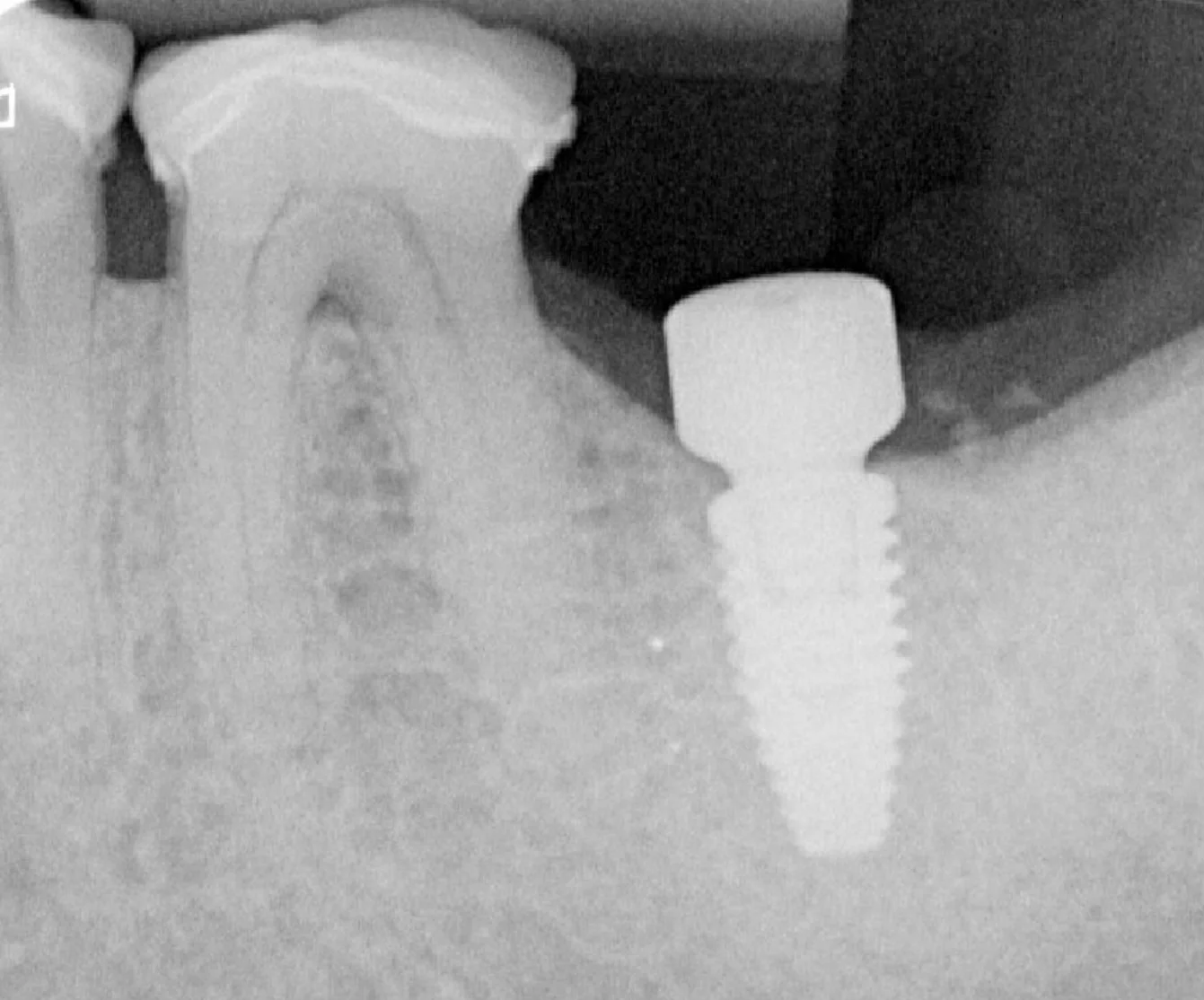 clinique dentaire waterloo - parodontologie implantologie et chirurgie dentaire à waterloo