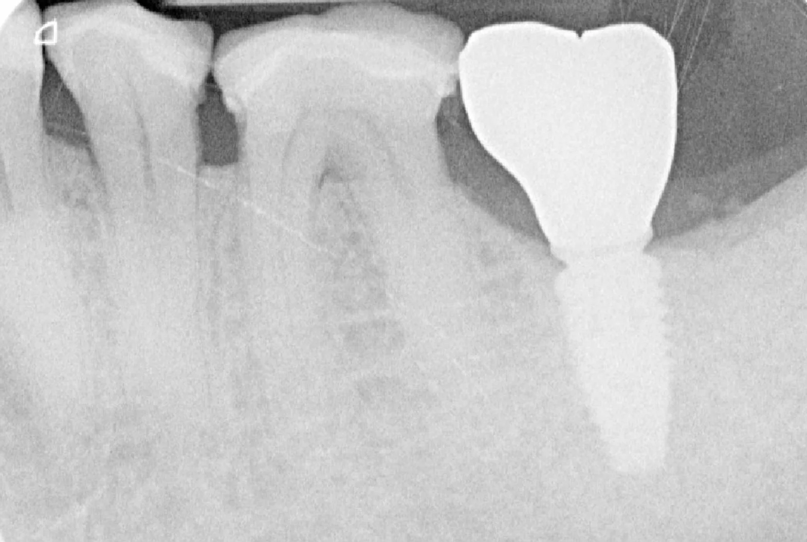 clinique dentaire waterloo - parodontologie implantologie et chirurgie dentaire à waterloo