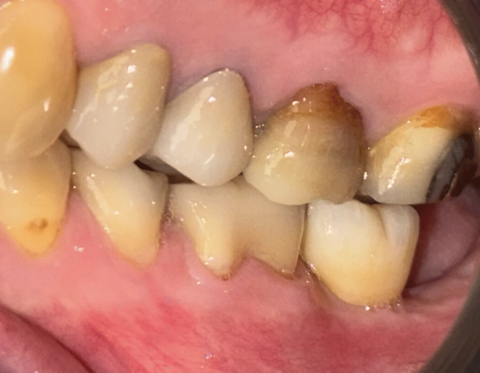 clinique dentaire waterloo - parodontologie implantologie et chirurgie dentaire à waterloo